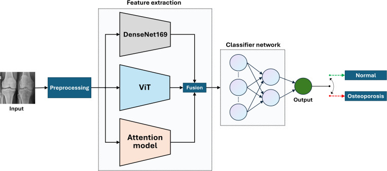 BONE-Net: A novel hybrid deep-learning model for effective osteoporosis detection.