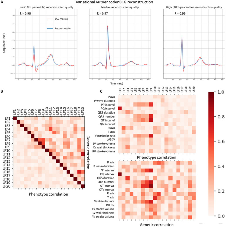 Unsupervised feature extraction using deep learning empowers discovery of genetic determinants of the electrocardiogram.