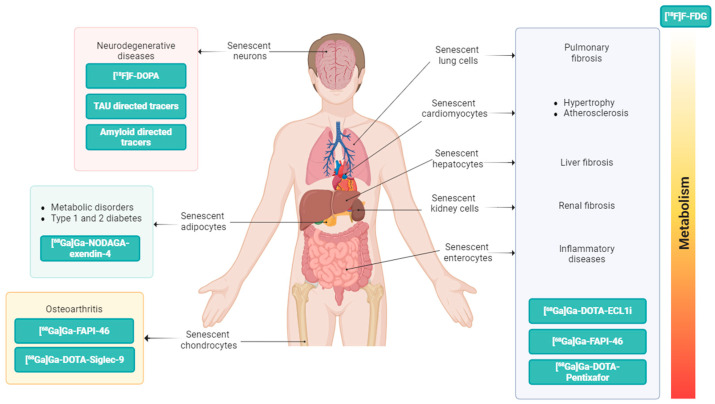 Emerging Radioligands as Tools to Track Multi-Organ Senescence.