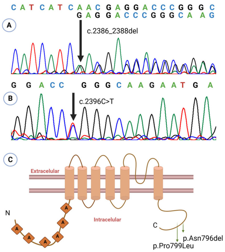 The Broad Clinical Spectrum of Metatropic Dysplasia: A Case Series and Literature Review.