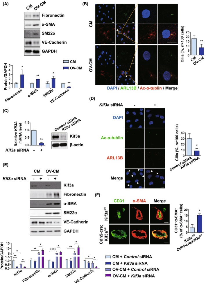 Loss of primary cilia promotes EphA2-mediated endothelial-to-mesenchymal transition in the ovarian tumor microenvironment.