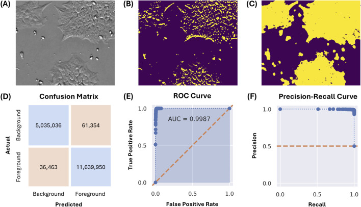 Advancing cell therapy manufacturing: an image-based solution for accurate confluency estimation.