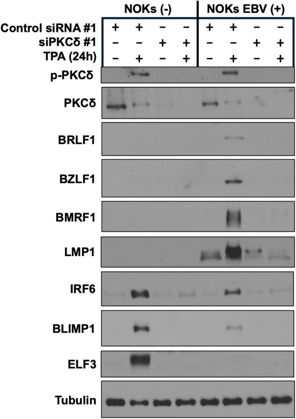 Correction: IRF6 controls Epstein-Barr virus (EBV) lytic reactivation and differentiation in EBV-infected epithelial cells.