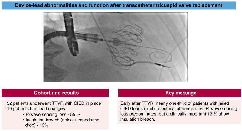 Device-lead abnormalities and function after transcatheter tricuspid valve replacement.
