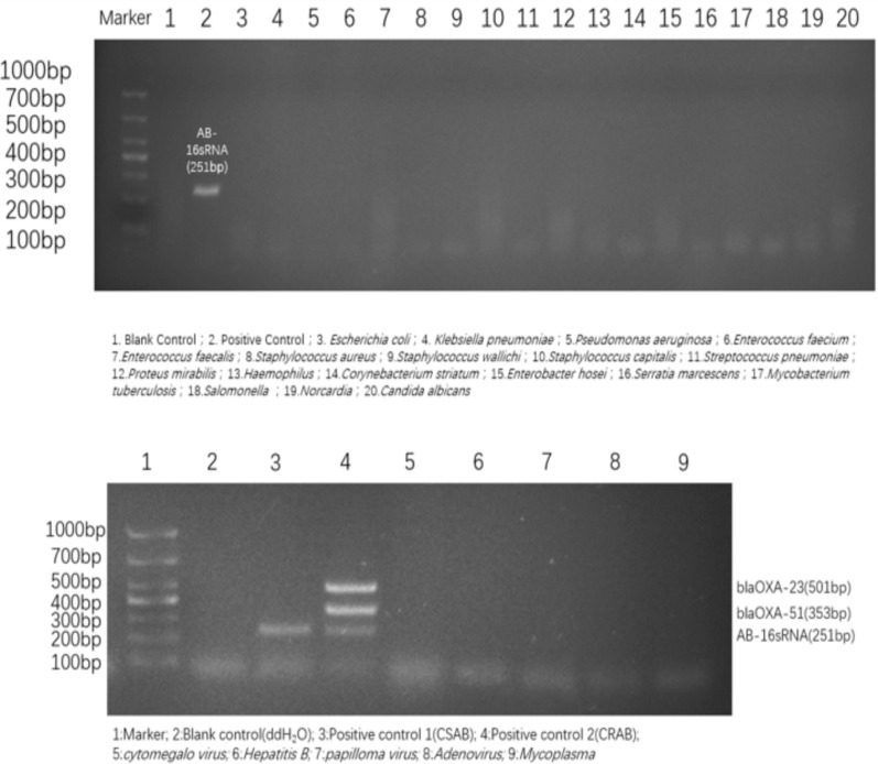 Development and clinical application of a PCR-UV assay for detection of carbapenem resistant Acinetobacter baumannii in bloodstream infections.