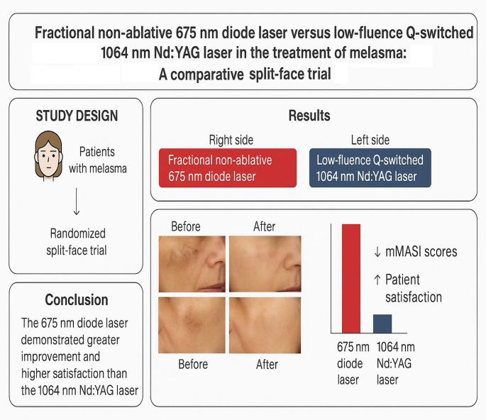 Fractional non ablative 675 nm diode laser versus low fluence high frequency Q- switched 1064 nm nd: YAG laser in the treatment of melasma: a comparative split face trial.
