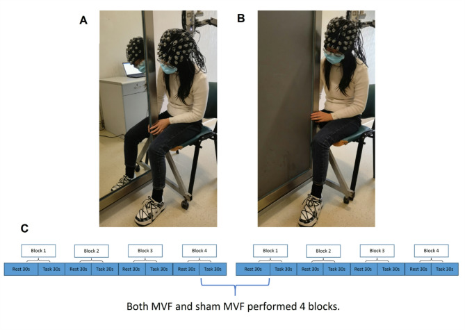 Effect of lower limb mirror visual feedback on cortical activation in healthy subjects: a self-controlled randomized trail.