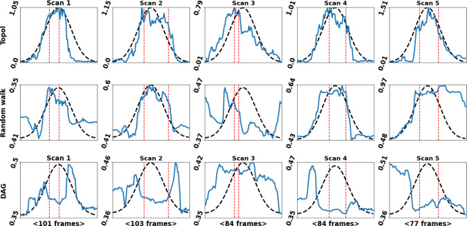 Identifying visible tissue in intraoperative ultrasound: a method and application.