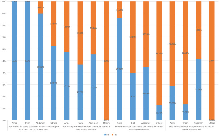 Short- and long-term complications of insulin pump therapy in children and adolescents with type 1 diabetes: a multicenter cross-sectional study from Saudi Arabia.