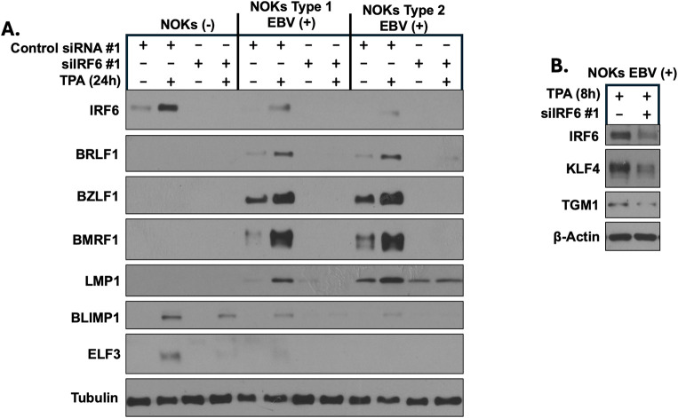 Correction: IRF6 controls Epstein-Barr virus (EBV) lytic reactivation and differentiation in EBV-infected epithelial cells.