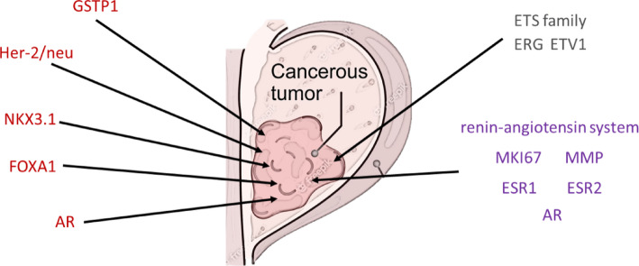 The molecular aspects in prostatic cancer, unraveling the role of CDKs in prostate cancer progression.