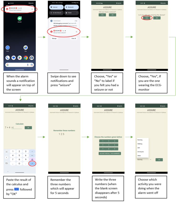 Seizure detection using wearable electrocardiogram connected to a smartphone: a phase 3 clinical validation study.