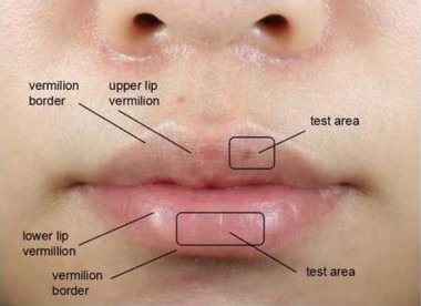 Biophysical Characteristics of Lip Vermilion among Healthy Individuals in Southern China -- Correlations between Age and Vermilion Physiology.