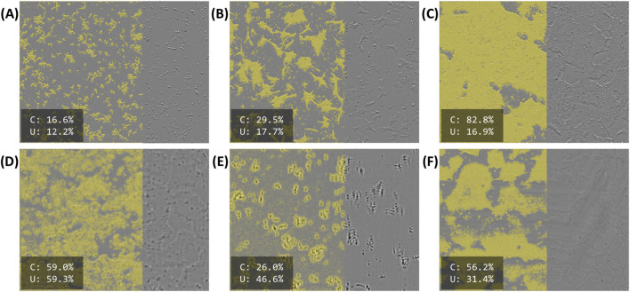 Advancing cell therapy manufacturing: an image-based solution for accurate confluency estimation.