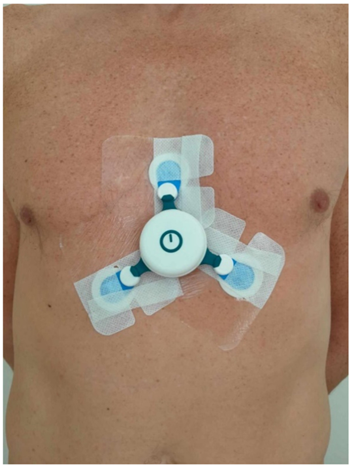Seizure detection using wearable electrocardiogram connected to a smartphone: a phase 3 clinical validation study.
