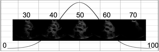 Identifying visible tissue in intraoperative ultrasound: a method and application.