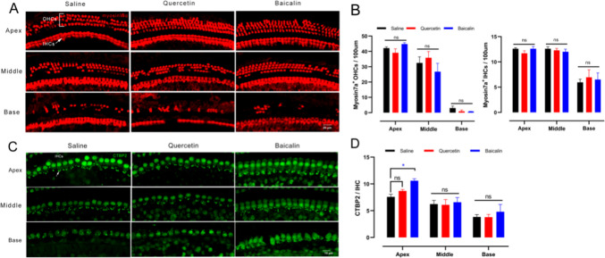 Correction to: Exploring the bioactive ingredients of three traditional Chinese medicine formulas against age-related hearing loss through network pharmacology and experimental validation.