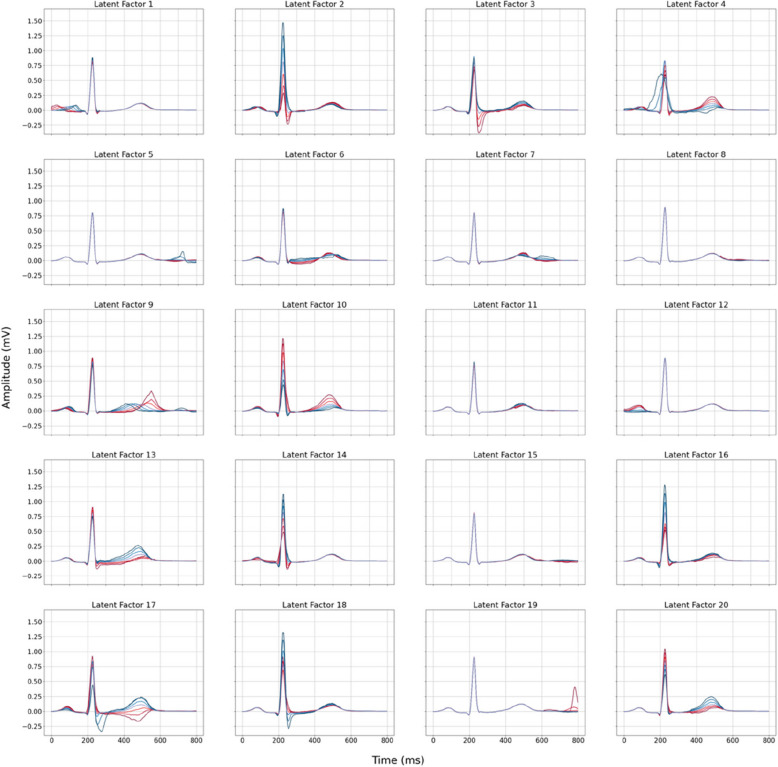 Unsupervised feature extraction using deep learning empowers discovery of genetic determinants of the electrocardiogram.