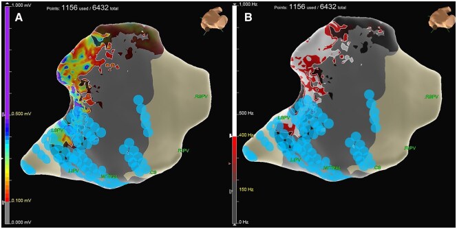 Robotic Hybrid Ablation with Novel Epicardial Electrophysiological Mapping: Impact on Atrial Fibrillation Therapy.
