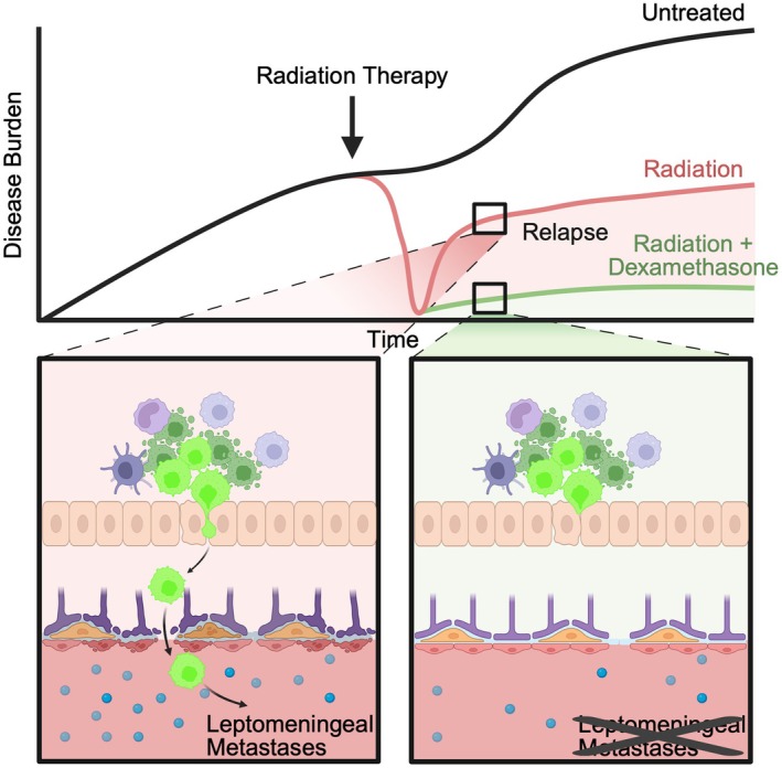 Only the strong survive: therapeutic selective pressure drives medulloblastoma leptomeningeal metastasis.