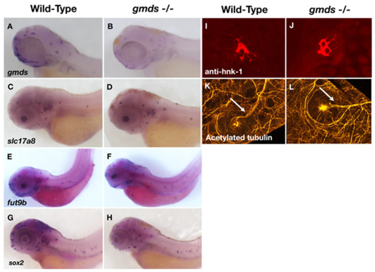 Mutation of the GDP-Fucose Biosynthesis Gene <i>gmds</i> Increases Hair Cell Number and Neuromast Regenerative Capacity in Zebrafish.