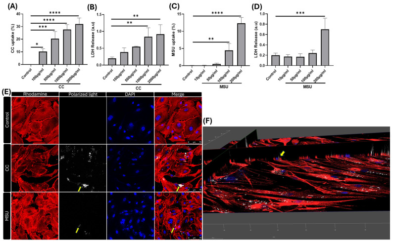 Atherosclerotic Plaque Crystals Induce Endothelial Dysfunction.
