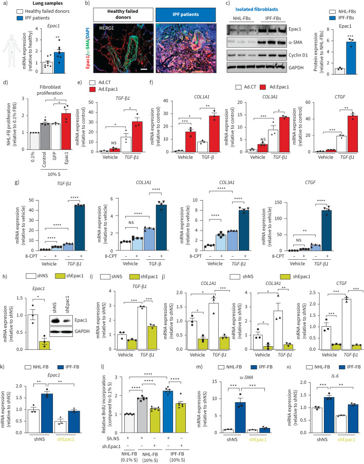 Pharmacological inhibition of Epac1 protects against pulmonary fibrosis by blocking FoxO3a neddylation.