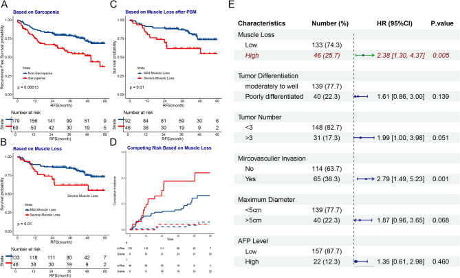 Machine learning predicts post-transplant muscle loss in hepatocellular carcinoma patients without sarcopenia.