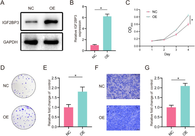 Deciphering the crucial role of IGF2BP3 in modulating stemness traits of salivary adenoid cystic carcinoma.