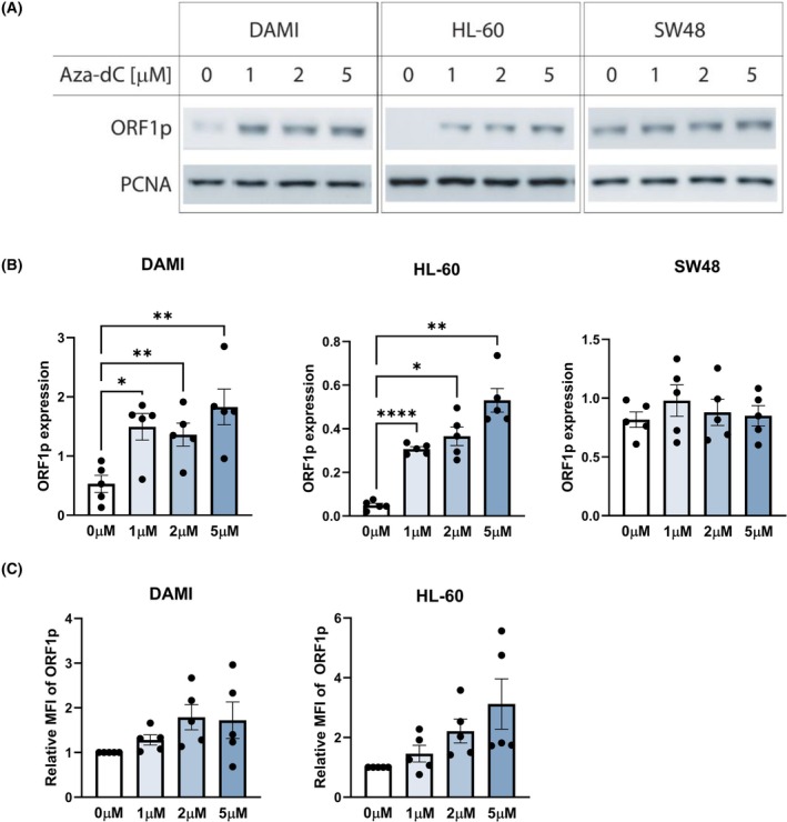Hypomethylating agents increase L1 retroelement expression without inducing novel insertions in myeloid malignancies.