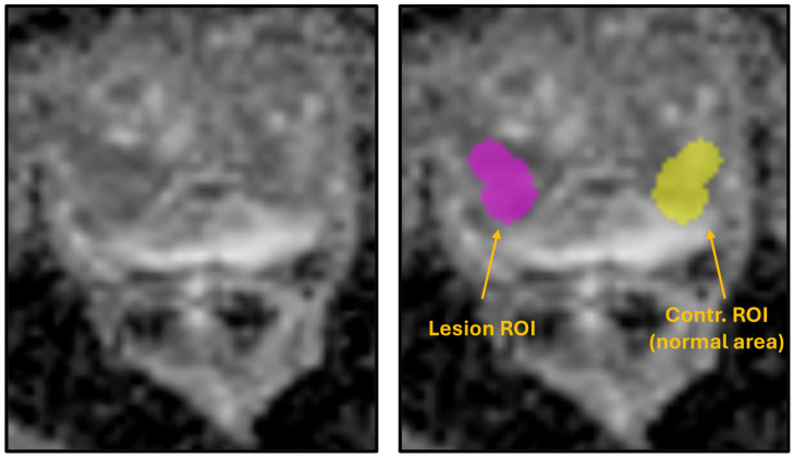 Beyond Radiomics Alone: Enhancing Prostate Cancer Classification with ADC Ratio in a Multicenter Benchmarking Study.