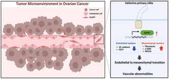 Loss of primary cilia promotes EphA2-mediated endothelial-to-mesenchymal transition in the ovarian tumor microenvironment.