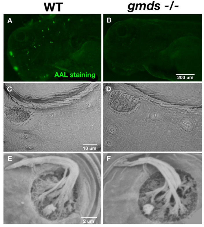 Mutation of the GDP-Fucose Biosynthesis Gene <i>gmds</i> Increases Hair Cell Number and Neuromast Regenerative Capacity in Zebrafish.