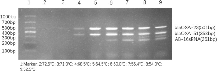Development and clinical application of a PCR-UV assay for detection of carbapenem resistant Acinetobacter baumannii in bloodstream infections.