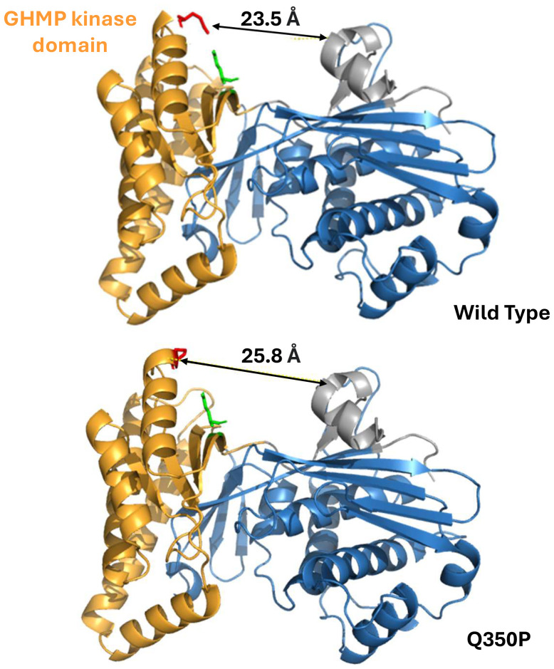 Case Report: Mevalonate kinase deficiency: an underdiagnosed cause of ischemic stroke-characterization of a novel genetic variant.