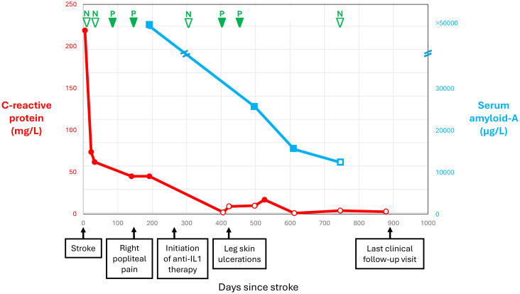 Case Report: Mevalonate kinase deficiency: an underdiagnosed cause of ischemic stroke-characterization of a novel genetic variant.