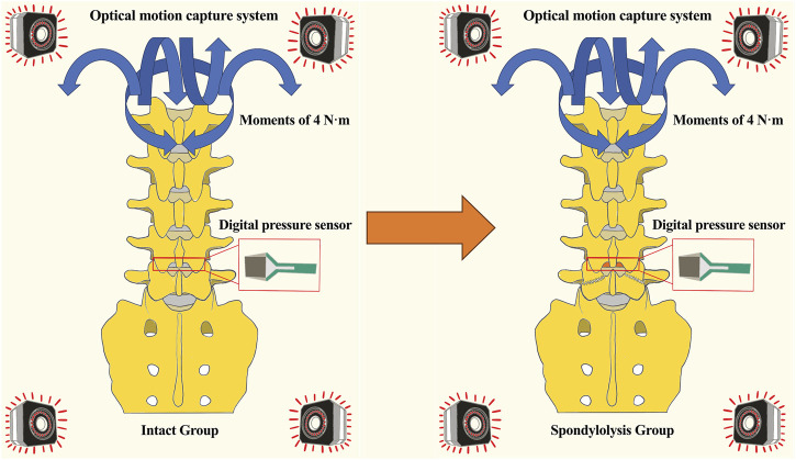 L5 spondylolysis increases segmental mobility at the cranial adjacent level without altering intervertebral disc contact pressure.
