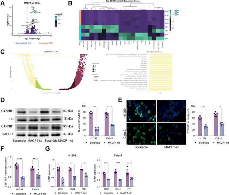 Transcriptional activation of MACF1 by NR2F1 drives WNT-mediated focal adhesion and metastasis in lung adenocarcinoma.
