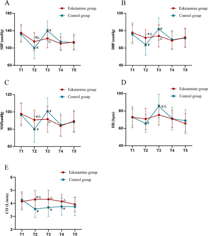 Esketamine attenuates hemodynamic oscillations during anesthesia induction in elderly gastrointestinal surgical patients: a randomized trial.