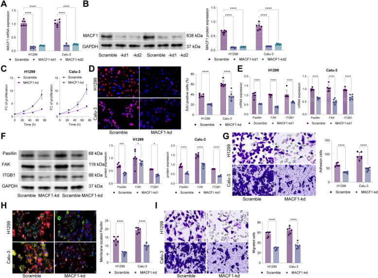 Transcriptional activation of MACF1 by NR2F1 drives WNT-mediated focal adhesion and metastasis in lung adenocarcinoma.