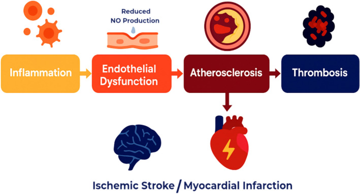 Decoding the link between ischemic stroke and myocardial infarction: a pathophysiological and clinical perspective.