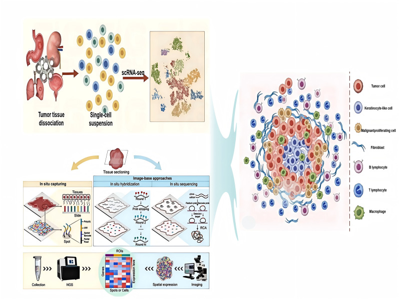Single-cell and spatial transcriptomics integration: new frontiers in tumor microenvironment and cellular communication.