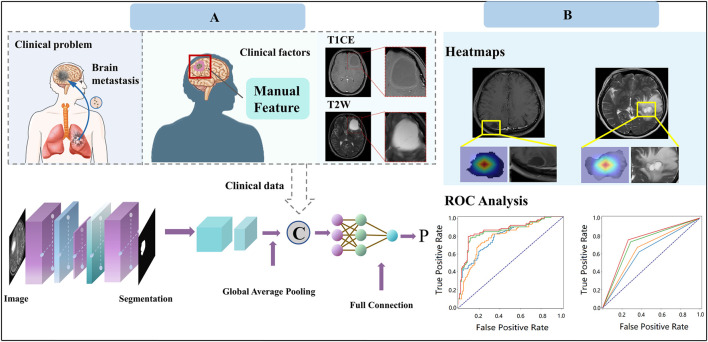 Deep learning on brain metastasis for predicting EGFR genotype and EGFR-TKI therapy response in metastatic NSCLC: a multicenter study.