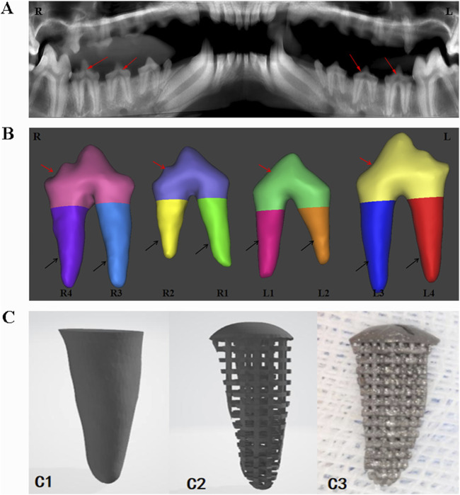 Animal experiment on osseointegration of porous titanium root analogue implants with composite CSn-TAK242 coating.