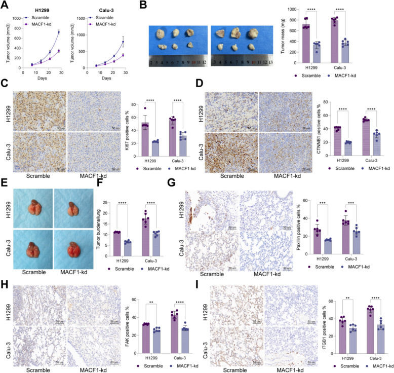 Transcriptional activation of MACF1 by NR2F1 drives WNT-mediated focal adhesion and metastasis in lung adenocarcinoma.