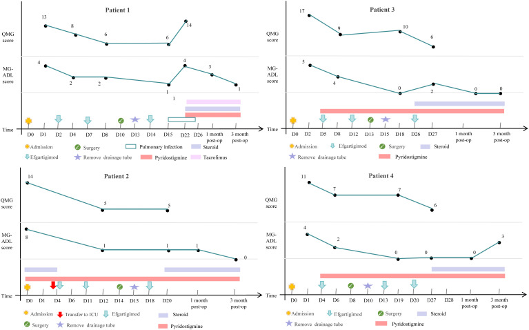 Efgartigimod for patients with thymoma associated generalized myasthenia gravis during the perioperative period: a four-case report.