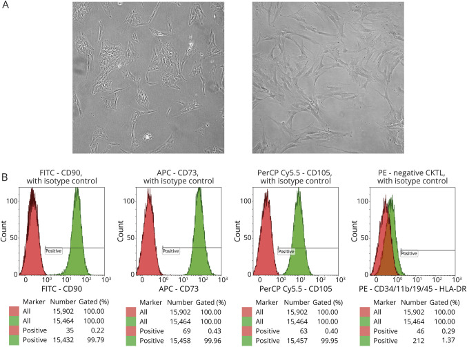 Proinflammatory Effect of Mesenchymal Stem Cells From Patients With Multiple Sclerosis: Potential Modulation Targets.