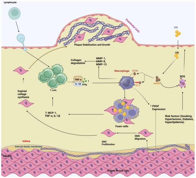 Epigenetic‑ncRNA crosstalk in atherosclerosis: Mechanisms, disease progression and therapeutic potential (Review).