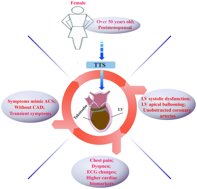 Takotsubo syndrome: Unraveling the mystery behind its triggers (Review).