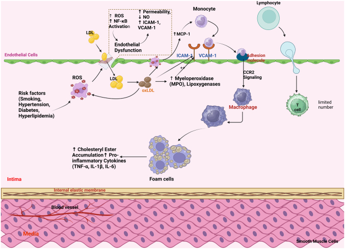 Epigenetic‑ncRNA crosstalk in atherosclerosis: Mechanisms, disease progression and therapeutic potential (Review).